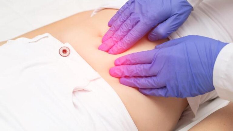 Çikolata Kisti Belirtileri Nelerdir? Çikolata Kisti Nasıl Anlaşılır? Tedavi Yöntemleri Nelerdir?